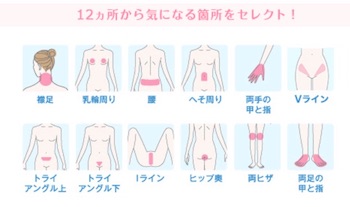 ミュゼ フリーセレクト美容脱毛コース