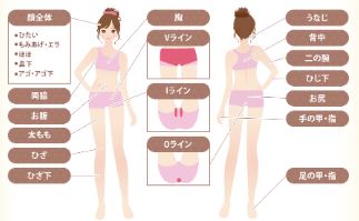 クレアクリニック 脱毛部位