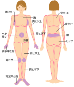 エルセーヌ 全身脱毛範囲
