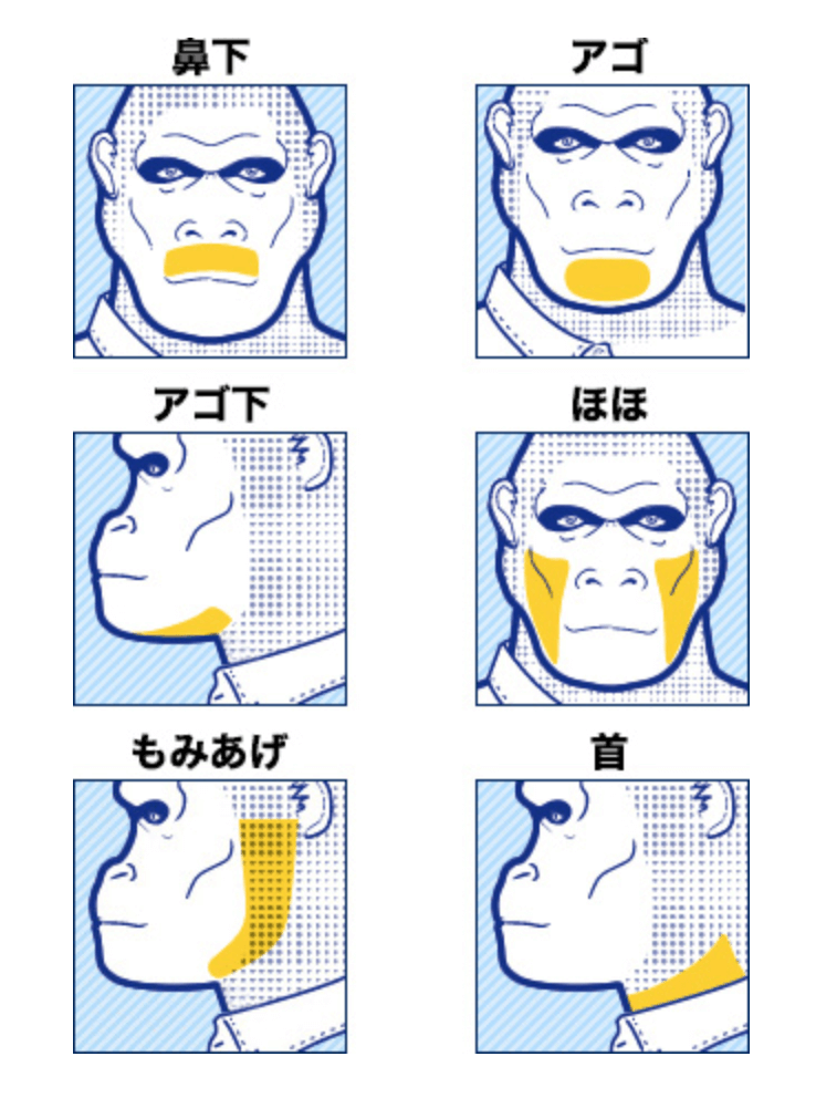 ゴリラクリニック パーツ別ひげ脱毛