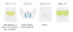 ハロス VIO脱毛できる範囲