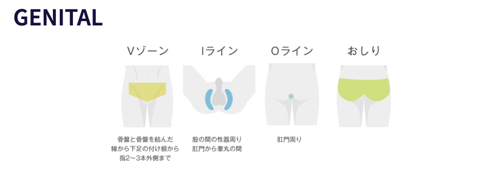 ハロス VIO脱毛できる範囲