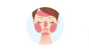 フェミークリニック 顔脱毛範囲