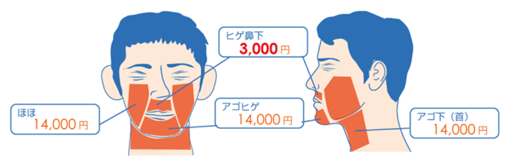 KM新宿クリニック メンズ 顔脱毛できる範囲
