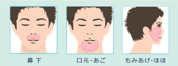 メンズ ラ・パルレ ヒゲ脱毛