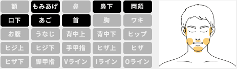 メンズキレイモ ヒゲ脱毛 範囲