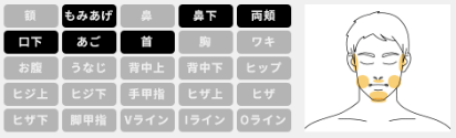 メンズキレイモ ヒゲ脱毛 範囲