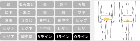 メンズキレイモ VIO脱毛 範囲