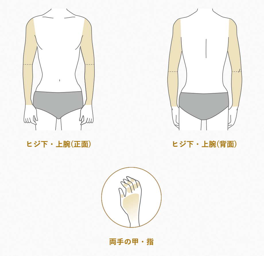 メンズTBC脱毛範囲ウデ