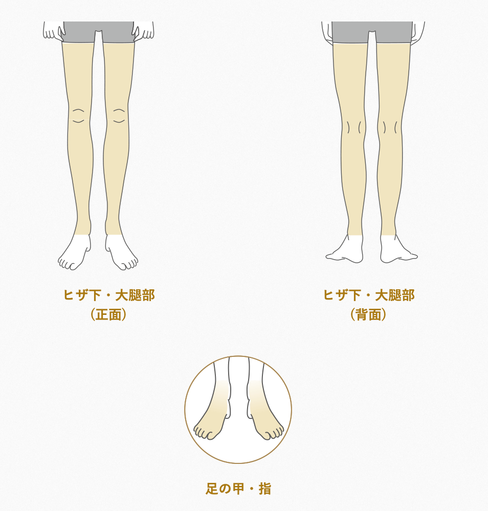 メンズTBC脱毛範囲足