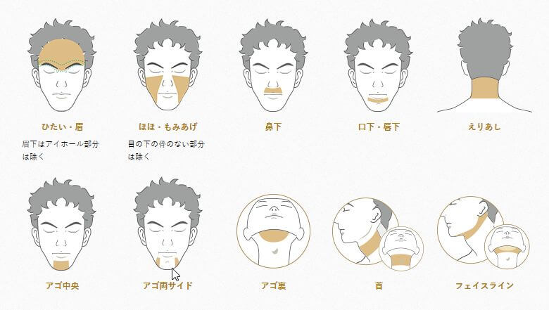 メンズTBCスーパー脱毛 顔の範囲