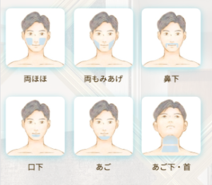 RINX(リンクス)ヒゲの脱毛範囲