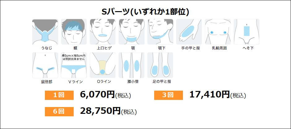 湘南美容 Sパーツ 料金