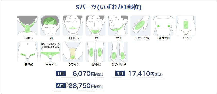 湘南美容 Sパーツ 料金