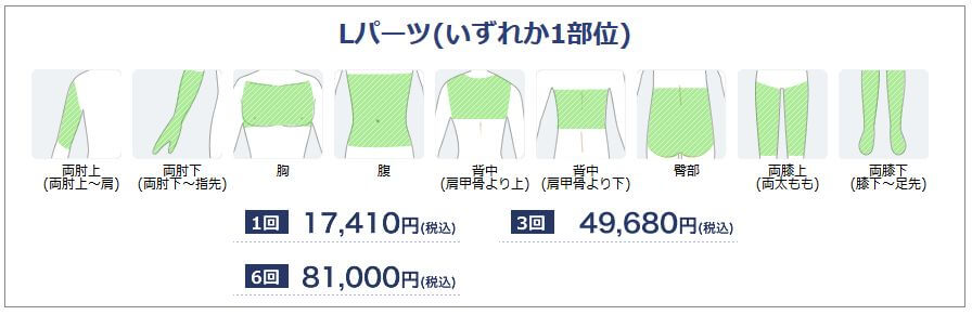 湘南美容 Lパーツ 料金