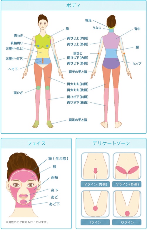 聖心美容クリニック 脱毛範囲