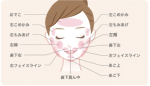 ストラッシュ 顔脱毛 範囲
