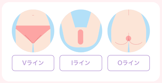 ウィクリニック VIO脱毛 範囲