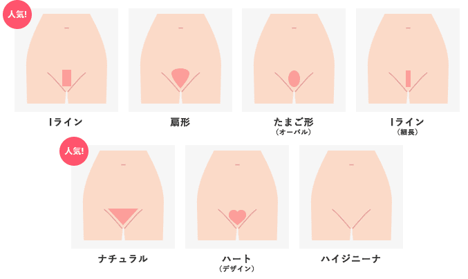 ウィクリニック VIO脱毛 デザイン