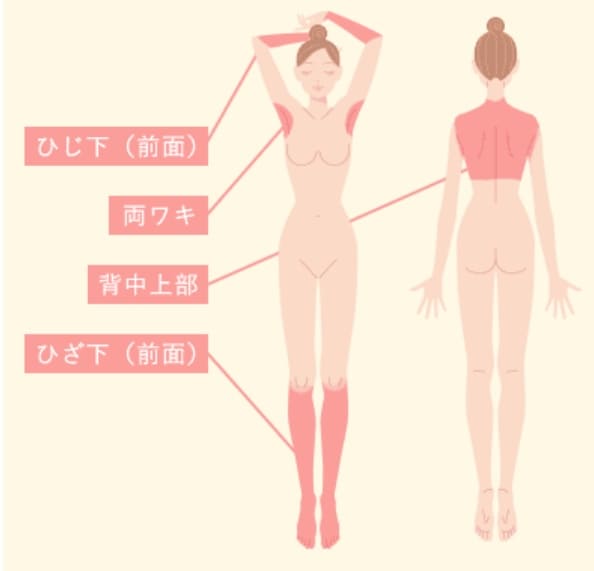 ウィクリニック 全身脱毛ライト 脱毛範囲