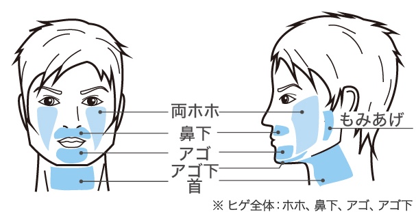 横浜中央クリニック ヒゲ脱毛 範囲