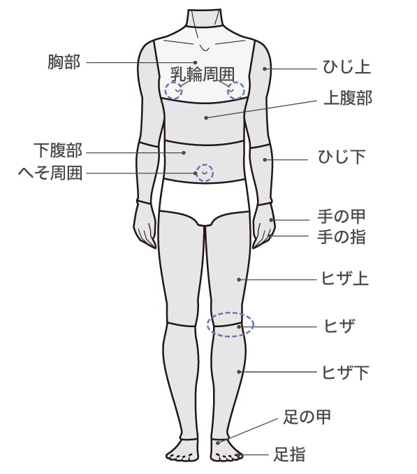 横浜中央クリニック 全身脱毛 前面範囲