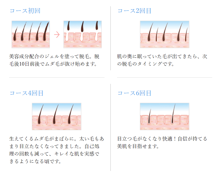 TBC ライト脱毛
